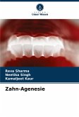 Zahn-Agenesie