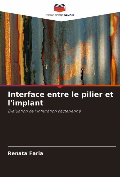Interface entre le pilier et l'implant Interface entre le pilier et l'implant