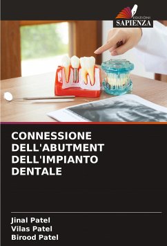 CONNESSIONE DELL'ABUTMENT DELL'IMPIANTO DENTALE - Patel, Jinal;Patel, Vilas;Patel, Birood