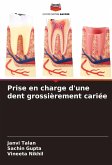 Prise en charge d'une dent grossièrement cariée