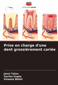 Prise en charge d'une dent grossièrement cariée - Talan, Janvi;Gupta, Sachin;Nikhil, Vineeta