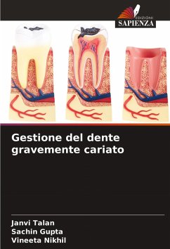 Cover Gestione del dente gravemente cariato