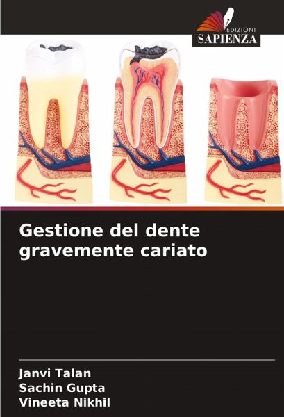 Gestione del dente gravemente cariato