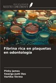 Fibrina rica en plaquetas en odontología