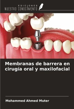 Membranas de barrera en cirugía oral y maxilofacial - Ahmed Muter, Mohammed