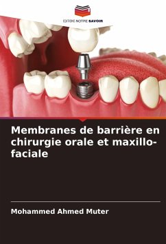 Membranes de barrière en chirurgie orale et maxillo-faciale - Ahmed Muter, Mohammed