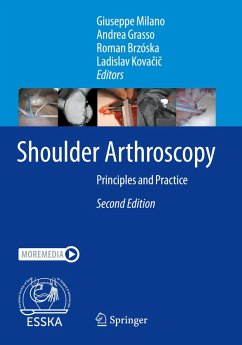 Cover Shoulder Arthroscopy