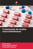 Tratamento de lesões vesiculobolhosas