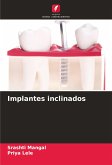Implantes inclinados