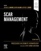 Procedures in Cosmetic Dermatology: Scar Management