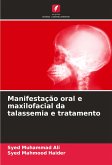 Manifestação oral e maxilofacial da talassemia e tratamento