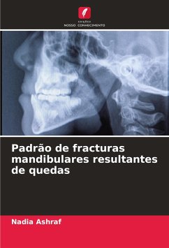 Padrão de fracturas mandibulares resultantes de quedas - Ashraf, Nadia