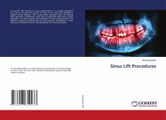 Cover Sinus Lift Procedures