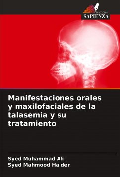 Manifestaciones orales y maxilofaciales de la talasemia y su tratamiento - Ali, Syed Muhammad; Haider, Syed Mahmood