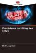 Procédures de lifting des sinus - Bild 1