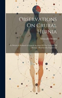 Observations On Crural Hernia: To Which Is Prefixed A General Account Of The Varieties Of Hernia: Illustratedby Engravings - Monro, Alexander