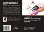 Localisation radiographique de l'apex et du foramen apical des molaires