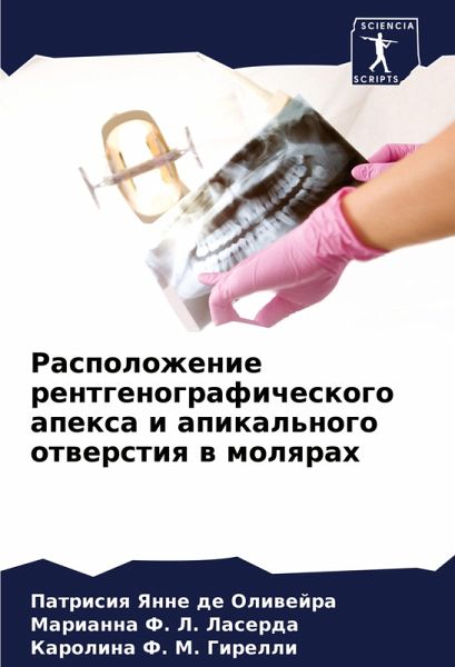 Raspolozhenie rentgenograficheskogo apexa i apikal'nogo otwerstiq w molqrah Raspolozhenie rentgenograficheskogo apexa i apikal'nogo otwerstiq w molqrah