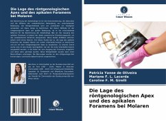 Die Lage des röntgenologischen Apex und des apikalen Foramens bei Molaren - de Oliveira, Patrícia Yanne; F. L. Lacerda, Mariane; F. M. Girelli, Caroline