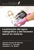 Localización del ápice radiográfico y del foramen apical en molares