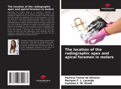 The location of the radiographic apex and apical foramen in molars - de Oliveira, Patrícia Yanne; F. L. Lacerda, Mariane; F. M. Girelli, Caroline
