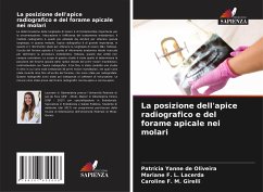 La posizione dell'apice radiografico e del forame apicale nei molari - de Oliveira, Patrícia Yanne; F. L. Lacerda, Mariane; F. M. Girelli, Caroline