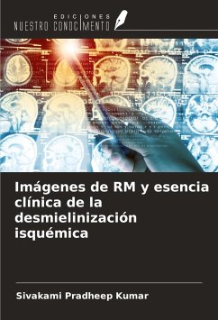 Imágenes de RM y esencia clínica de la desmielinización isquémica - Kumar, Sivakami Pradheep