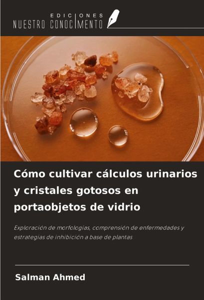 Cómo cultivar cálculos urinarios y cristales gotosos en portaobjetos de vidrio Cómo cultivar cálculos urinarios y cristales gotosos en portaobjetos de vidrio