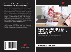 Lower calcific lithiasis: what to choose? USSR vs mini-NLPC! - BOUHNIK, Abdelhalim