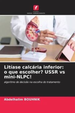 Litíase calcária inferior: o que escolher? USSR vs mini-NLPC! - BOUHNIK, Abdelhalim