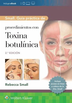 Small. Guía práctica de procedimientos con toxina botulínica - Small, Rebecca Small. Guía práctica de procedimientos con toxina botulínica - Small, Rebecca