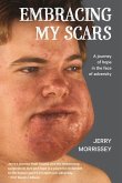 Embracing My Scars