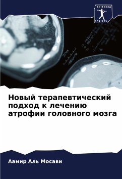 Cover Nowyj terapewticheskij podhod k lecheniü atrofii golownogo mozga