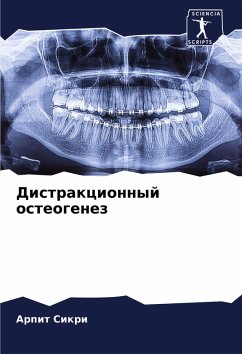 Cover Distrakcionnyj osteogenez