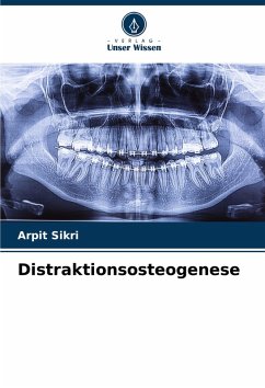 Cover Distraktionsosteogenese