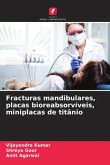 Fracturas mandibulares, placas bioreabsorvíveis, miniplacas de titânio