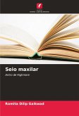 Seio maxilar