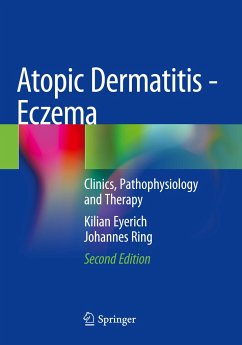 Atopic Dermatitis - Eczema - Eyerich, Kilian;Ring, Johannes