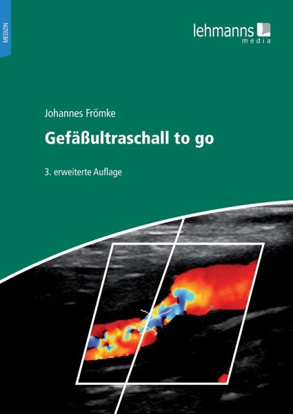 Gefäßultraschall to go (eBook, PDF) Gefäßultraschall to go (eBook, PDF)