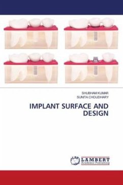 IMPLANT SURFACE AND DESIGN - Kumar, Shubham;Choudhary, Sunita