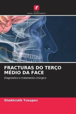 FRACTURAS DO TERÇO MÉDIO DA FACE - Yusupov, Shokhrukh