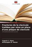 Fractures de la clavicule traitées par mise en place d'une plaque de clavicule