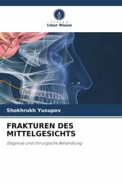 FRAKTUREN DES MITTELGESICHTS - Yusupov, Shokhrukh