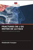 FRACTURES DE L'OS MOYEN DE LA FACE