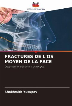 FRACTURES DE L'OS MOYEN DE LA FACE - Yusupov, Shokhrukh