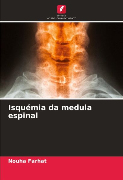 Isquémia da medula espinal Isquémia da medula espinal