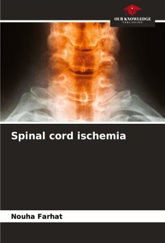 Spinal cord ischemia - Farhat, Nouha