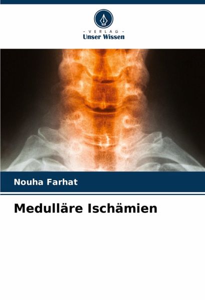 Medulläre Ischämien Medulläre Ischämien