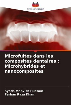 Microfuites dans les composites dentaires : Microhybrides et nanocomposites Cover Microfuites dans les composites dentaires : Microhybrides et nanocomposites