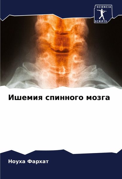 Ishemiq spinnogo mozga